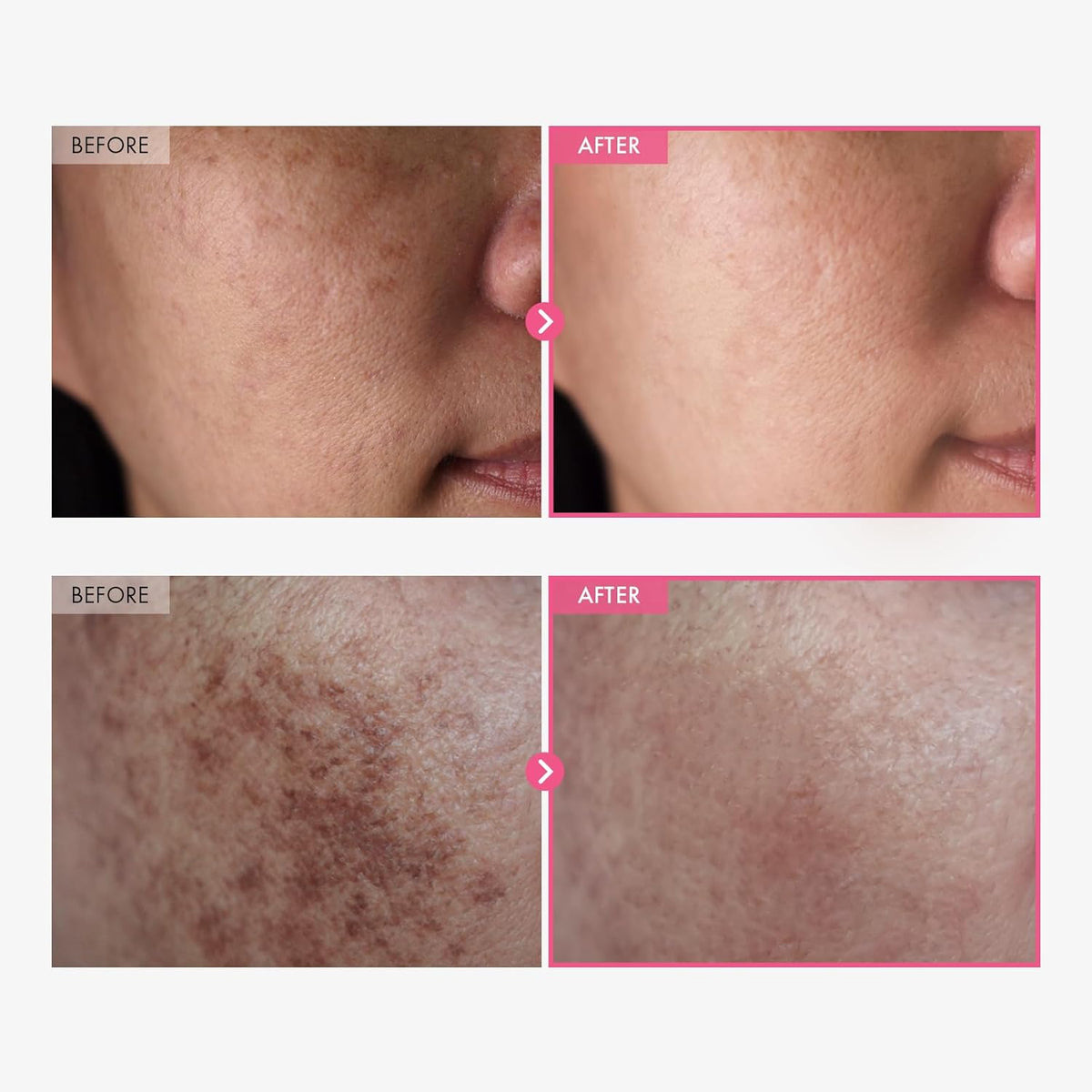 Korean Arbutin Brightening Cream